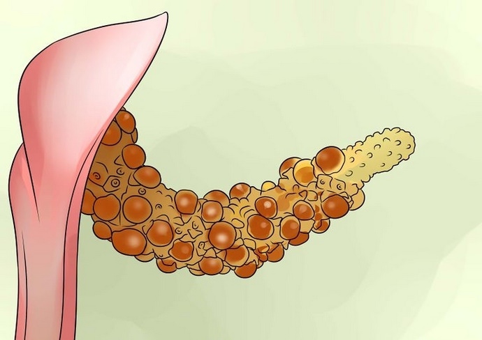 Размножить антуриум семенами возможно, но достаточно сложно